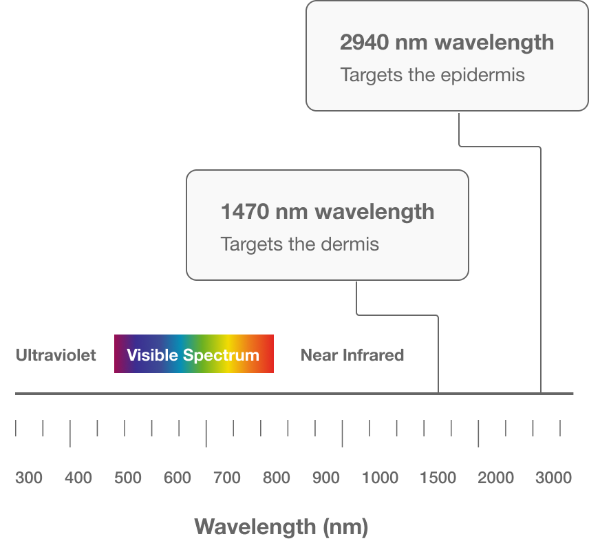 Chart showing HALO's 2940 nm wavelength targeting the epidermis and 1470 nm wavelength targeting the dermis on the light spectrum