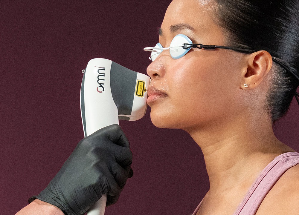 The OMNI precision handpiece treating the upper lip