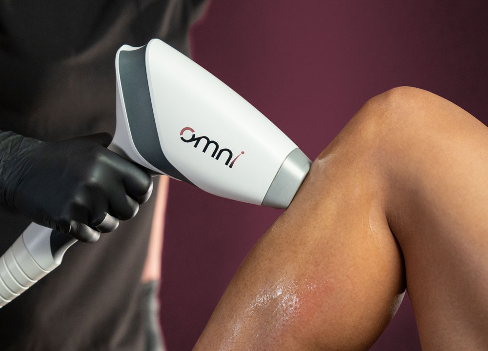 The OMNI large-area handpiece treating a leg