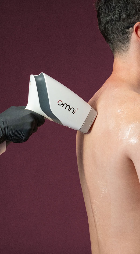 The OMNI large-area handpiece treating a shoulder and back